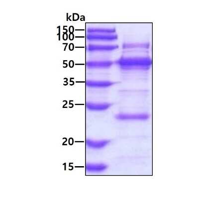 SDS-PAGE: Recombinant Human YARS2 His Protein [NBP1-98973]